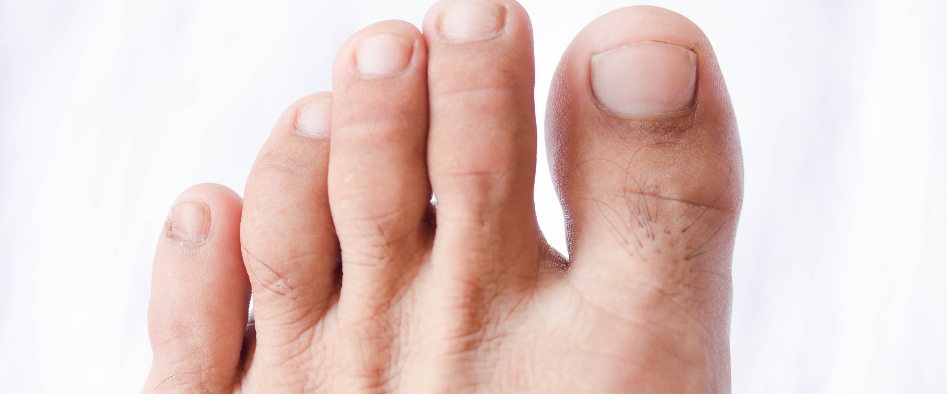 The Importance of Proper Toenail Care for Seniors