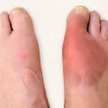 Expert's Perspective: Understanding Medical Conditions that Affect Feet