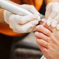 Expert Tips for Dealing with Thick Toenails