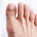 The Importance of Proper Toenail Care for Seniors