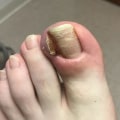 The True Cost of Toenail Cutting: What You Need to Know