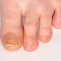 Expert Tips for Cutting Thick Toenails: How to Keep Your Feet Healthy