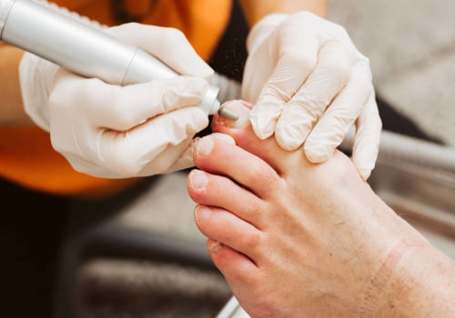 Expert Tips for Dealing with Thick Toenails