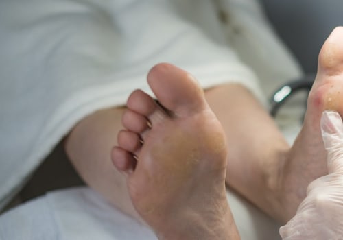 How often does medicare cover routine foot care?