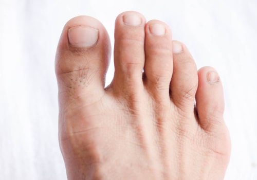 The Importance of Proper Toenail Care for Seniors