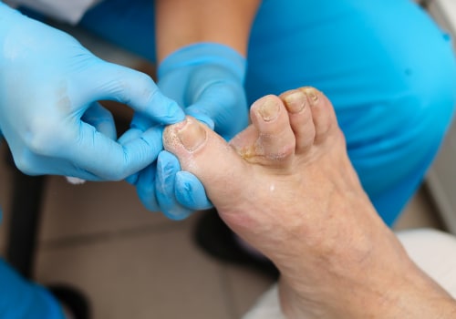 The True Cost of Toenail Cutting: What You Need to Know